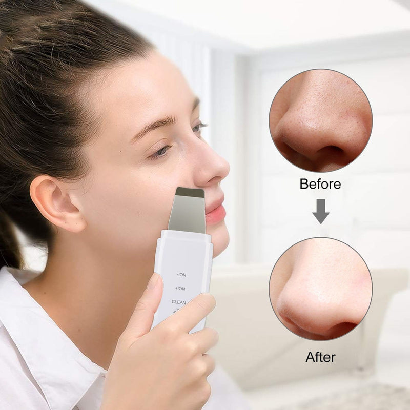 Bestsellrz® Ultrasonic Skin Exfoliator Scrub Spatula Acne Scraper- Dermoxo™ Ultrasonic Face Scrubber Dermoxo™